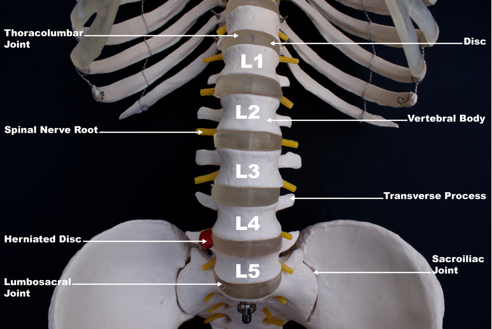 Lumbar Pain