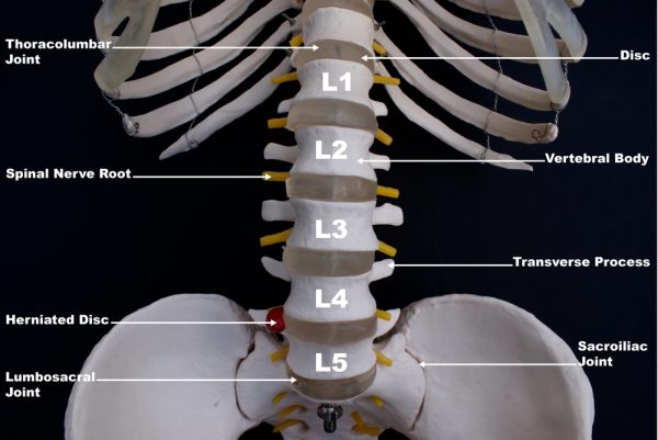 Lower Back Pain (Lumbar Pain)