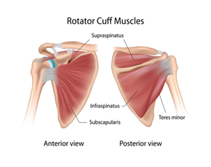 Rotator Cuff Tendonitis