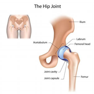 Hip Labral Tear