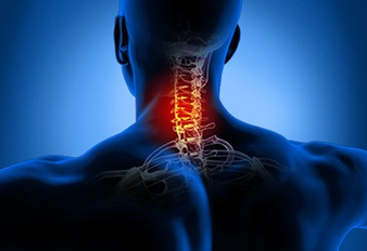 Cervical (Neck) Stiffness