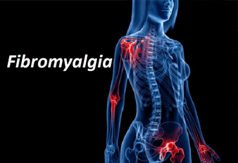 Fibromyalgia