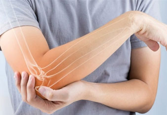 Carpal Tunnel Syndrome vs. Tennis Elbow vs. De Quervain Tendonitis: