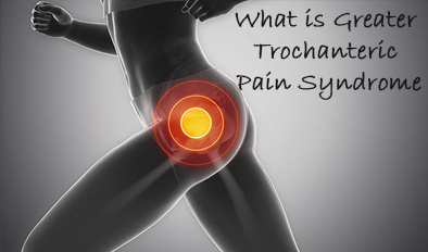 What is Greater Trochanteric Pain Syndrome