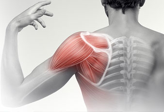 Shoulder pain