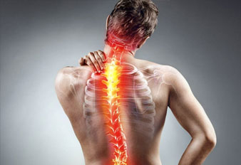 Scoliosis, the Unusual Curvature of the Spine
