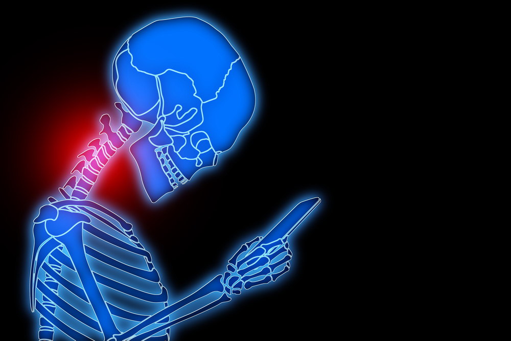 Chronic Cervical Stiffness