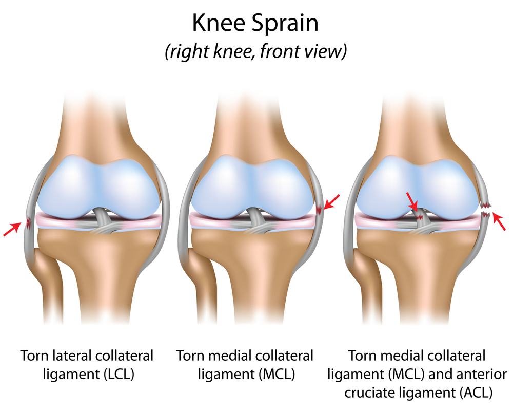 Knee Pain