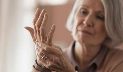 Rheumatoid Arthritis