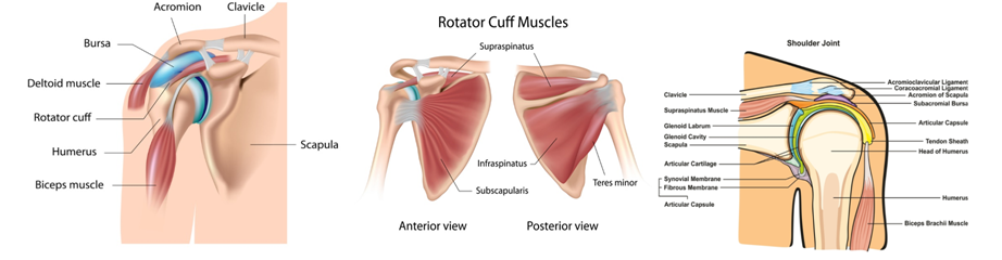 Shoulder bursitis