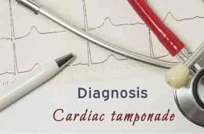 Cardiactamponade