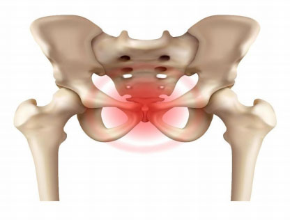 Osteitis Pubis
