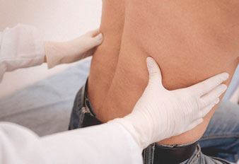 Intraspinal Facet Cysts