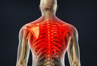 Thoracic Pain