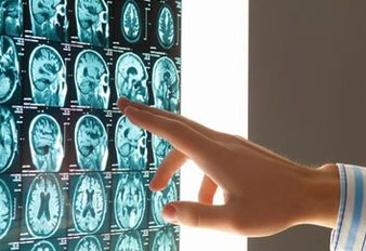 Penetrating Head Injuries