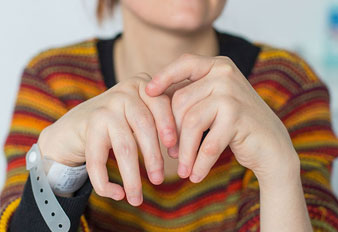 Rheumatoid Arthritis