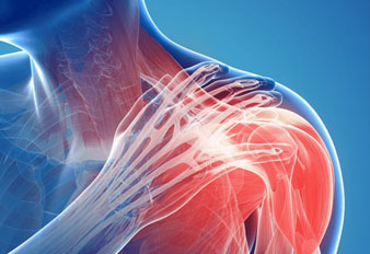 Shoulder Dislocation