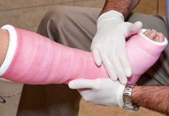 Open Tibial Fractures