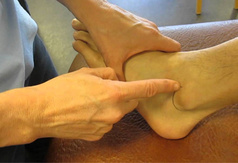 Lateral Malleolus